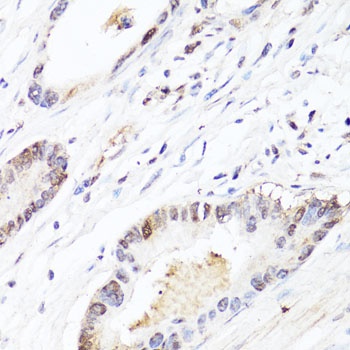 FGF12 Antibody