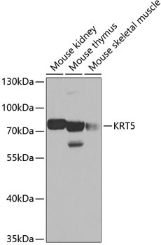 KRT5 Antibody