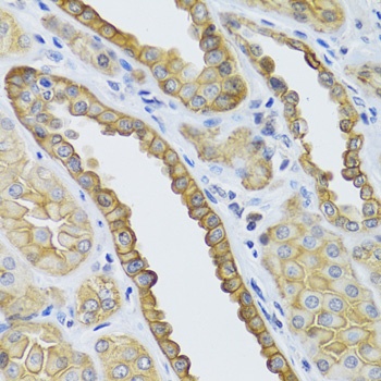KRT5 Antibody