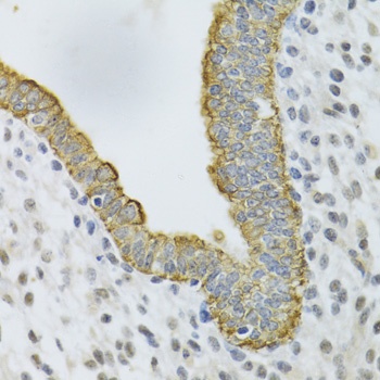 KRT5 Antibody