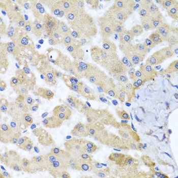 ABCB8 Antibody