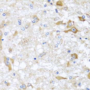 ABCB8 Antibody