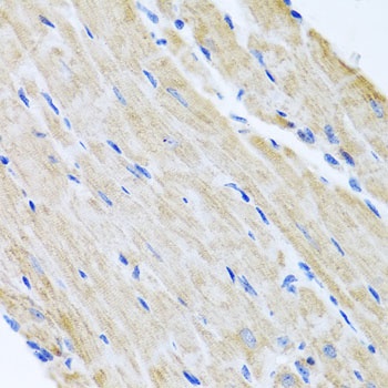 ABCB8 Antibody