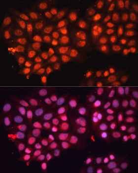 ABCB8 Antibody