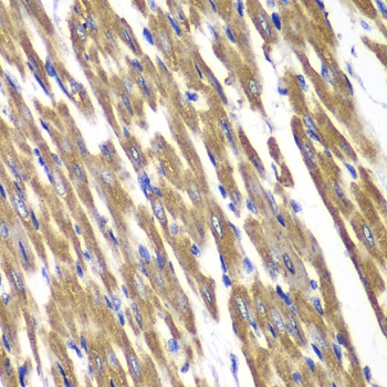 SDHA Antibody