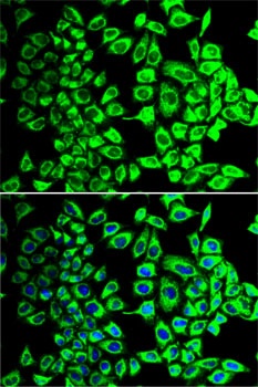 SDHA Antibody