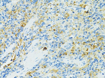 CD19 Antibody