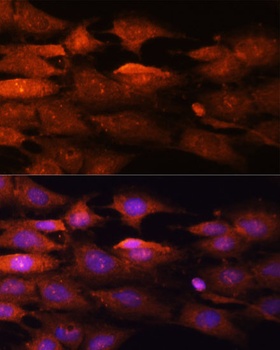 N-WASP Antibody