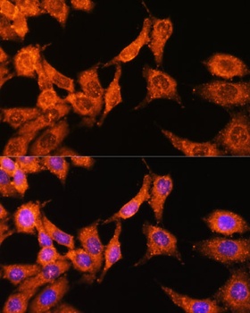 N-WASP Antibody