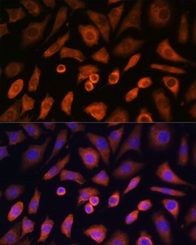 N-WASP Antibody