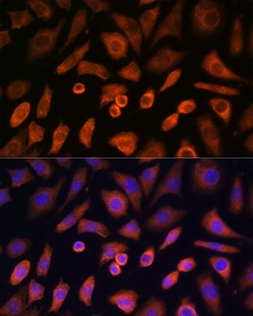 WASL Antibody