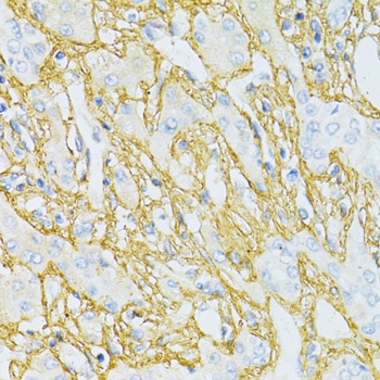 TGFBI Antibody