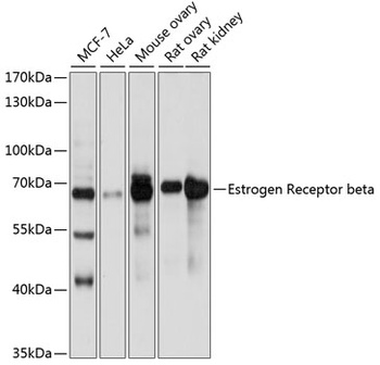 ESR2 Antibody