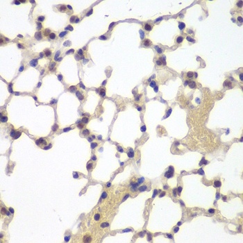 ESR2 Antibody