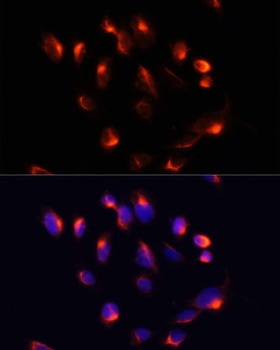 CYP3A4 Antibody