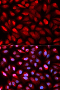 PCBP2 Antibody