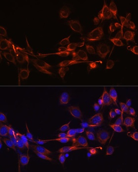 DKK3 Antibody