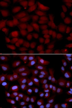 TNK2 Antibody