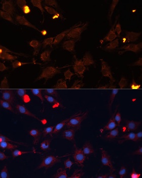 ADAMTS4 Antibody