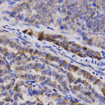 SNCG Antibody