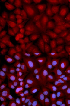 SNCG Antibody
