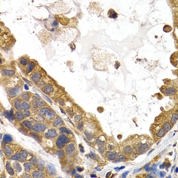 GYS1 Antibody