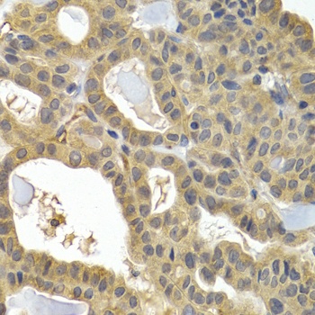 HSPB8 Antibody