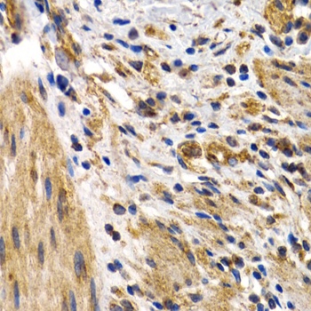 HSPB8 Antibody