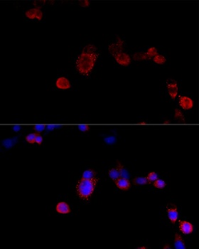 HSPB8 Antibody