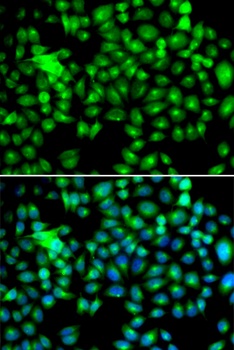 HSPB8 Antibody