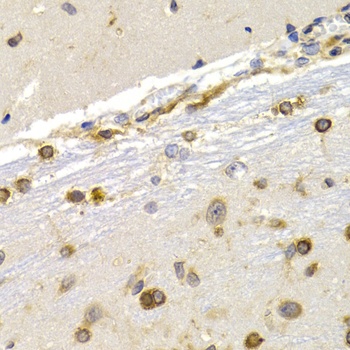 EEF1D Antibody