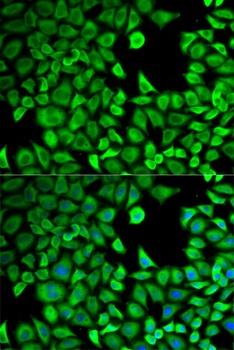 LTA4H Antibody