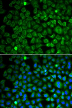 NUP62 Antibody