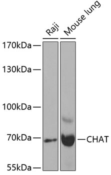 CHAT Antibody
