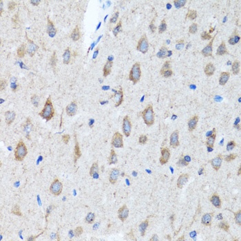 CHAT Antibody
