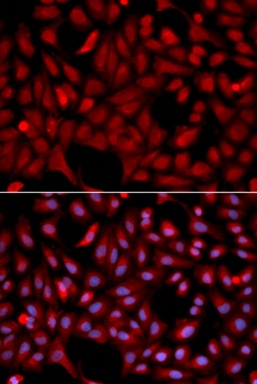 SIAH1 Antibody