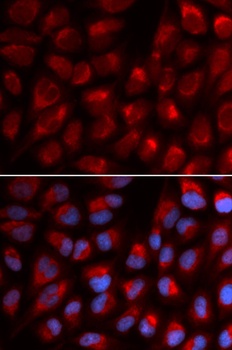 EPB41 Antibody