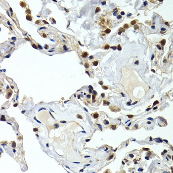 GTF2F1 Antibody