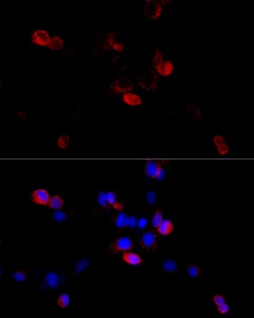 FLNB Antibody