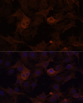 FLNB Antibody