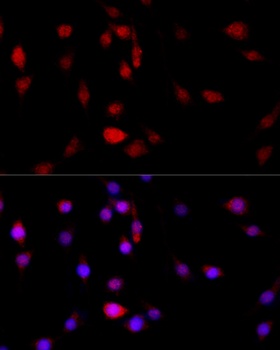 FLNB Antibody