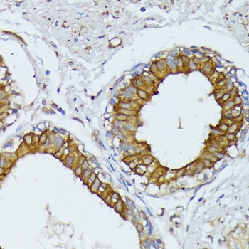 WNT1 Antibody