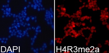H4R3me2a Antibody