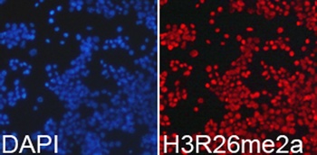 Asymmetric DiMethyl-Histone H3-R26 pAb