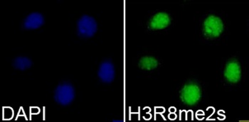 H3R8me2s Antibody