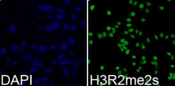 H3R2me2s Antibody