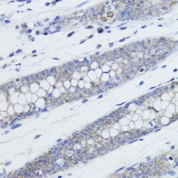 H4K20me1 Antibody