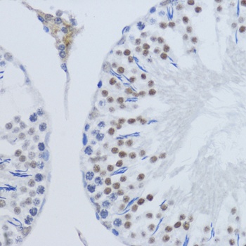 H3K79me2 Antibody