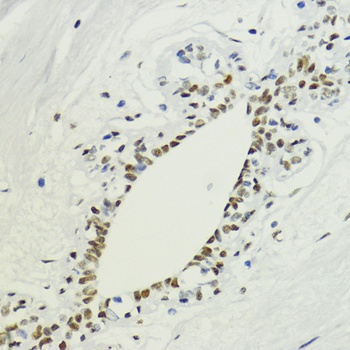 H3K36me2 Antibody