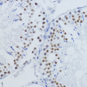 H3K36me2 Antibody